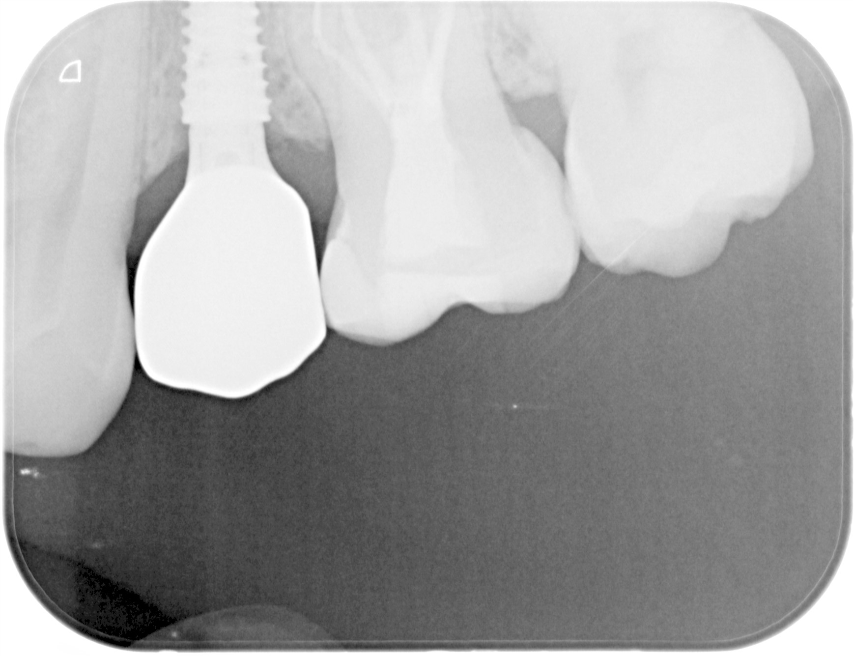 レントゲン写真