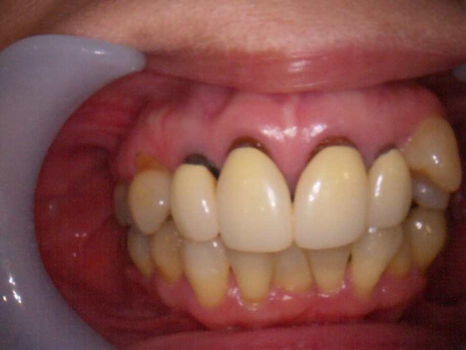 治療前（正面）